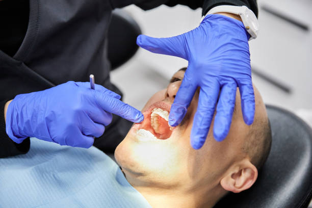 Best Dental Abscess Treatment in Mason City, IA